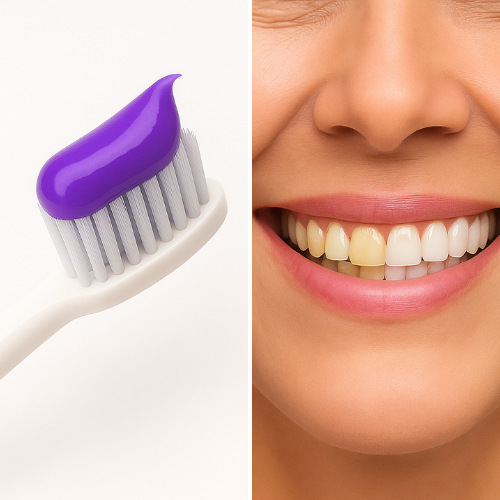 Corector V34-Flash Smile