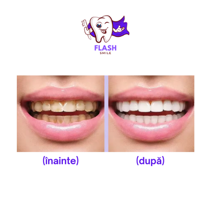 Corector V34-Flash Smile